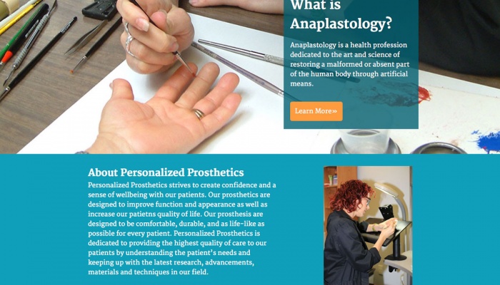 Personalized Prosthetics Personalized Prosthetics